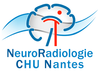 Service de NeuroRadiologie CHU de Nantes